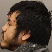 Austin Johnson Bolton’s left profile